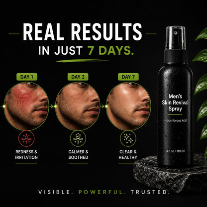 Skin Revival Spray - Hypochlorous Acid Face Mist